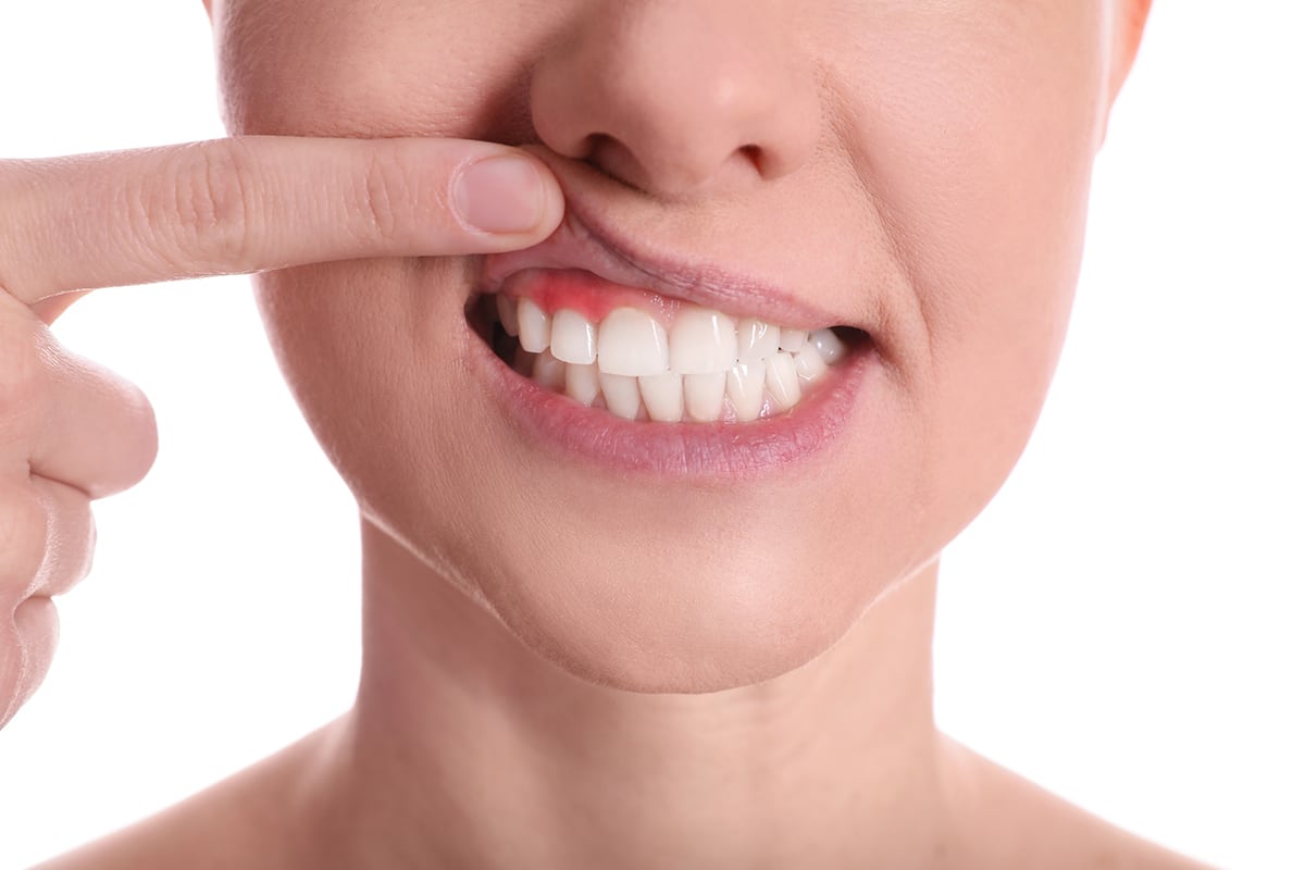 How untreated gum disease can lead to tooth loss blog