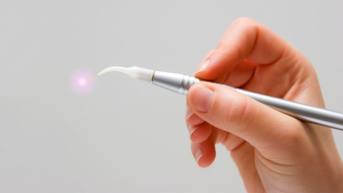 Laser Dentistry
