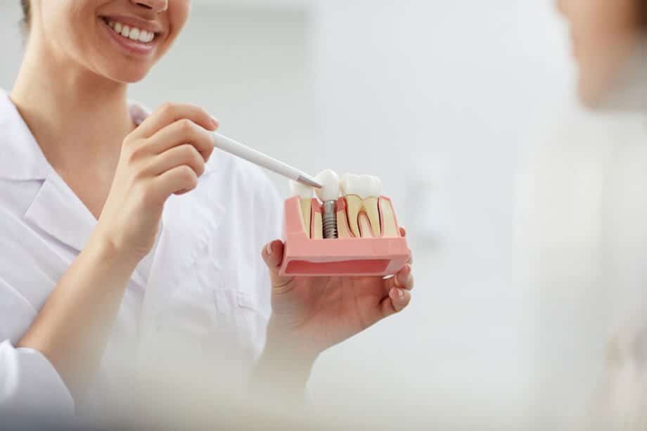 Woman pointing to dental implant model 920x613